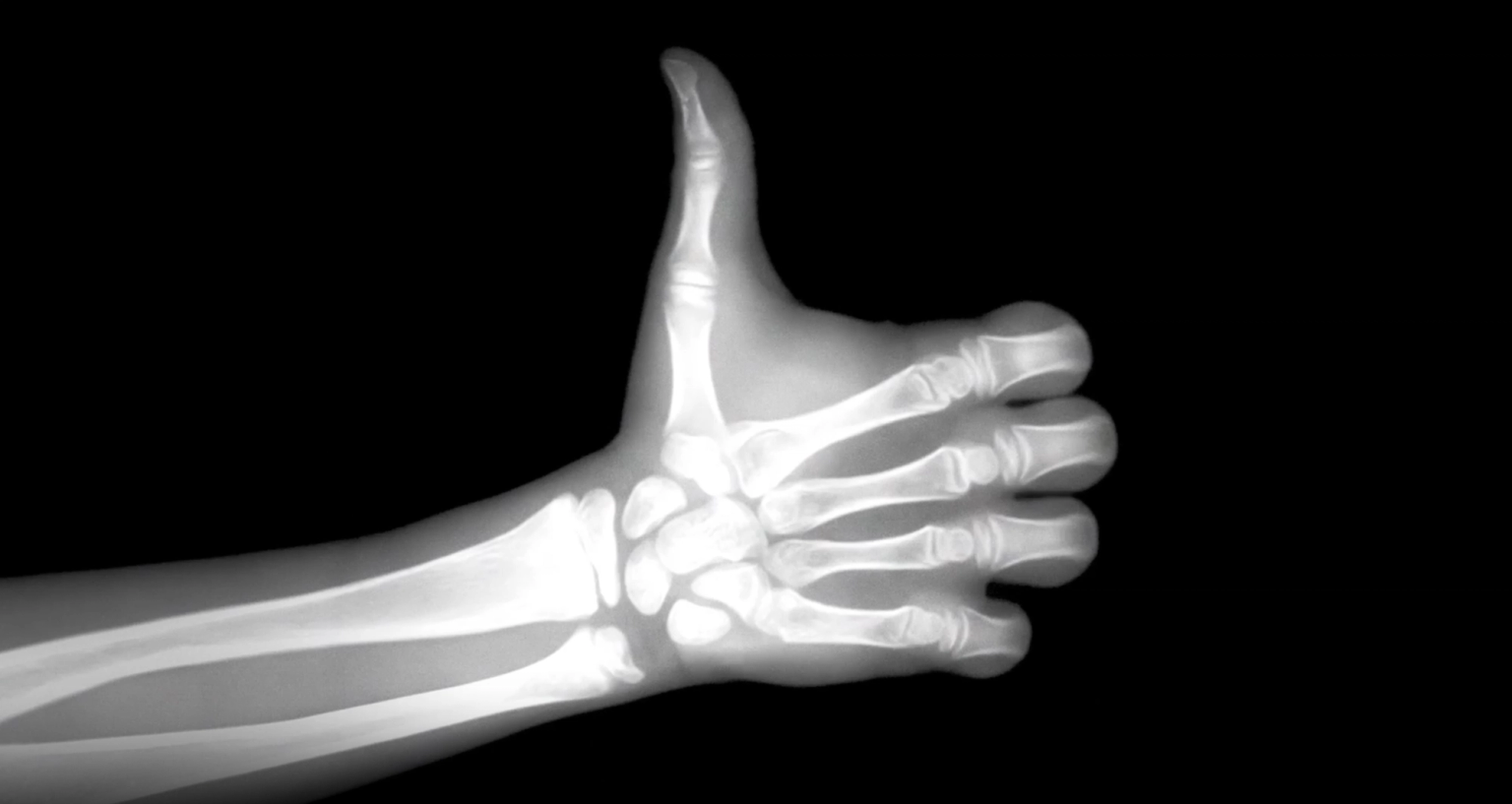 image-2ed0b0d43217b3905604e0fe1d445f8225a6c7d9-2940x1564-png