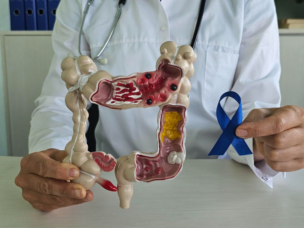 Žarnyno nelaikymas: Simptomai, priežastys, gydymas, prevencija