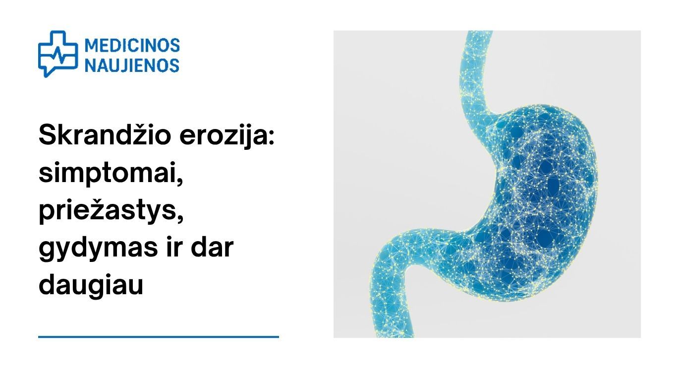 Skrandžio erozija: simptomai, priežastys, gydymas ir dar daugiau