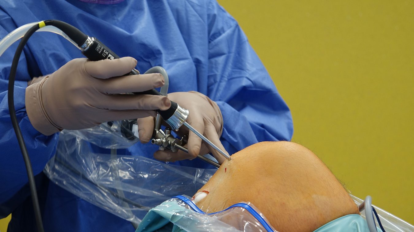Po kelio arterijų embolizacijos 74-erių moteris grįžo prie dviračio
