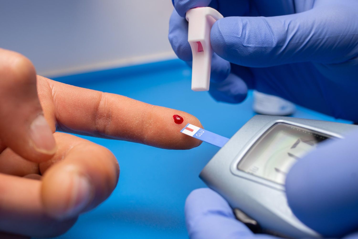 Hipoglikemija (mažas cukraus kiekis kraujyje): Simptomai, priežastys, gydymas, prevencija