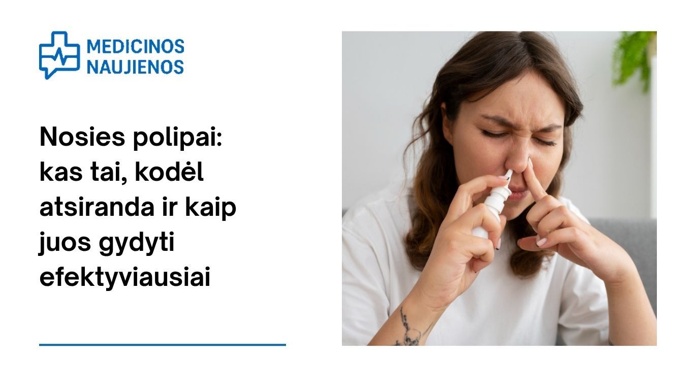 Nosies polipai: kas tai, kodėl atsiranda ir kaip juos gydyti efektyviausiai