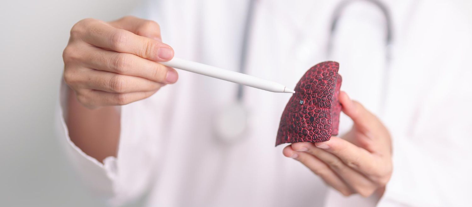 Kepenų navikai: Simptomai, priežastys, gydymas, prevencija