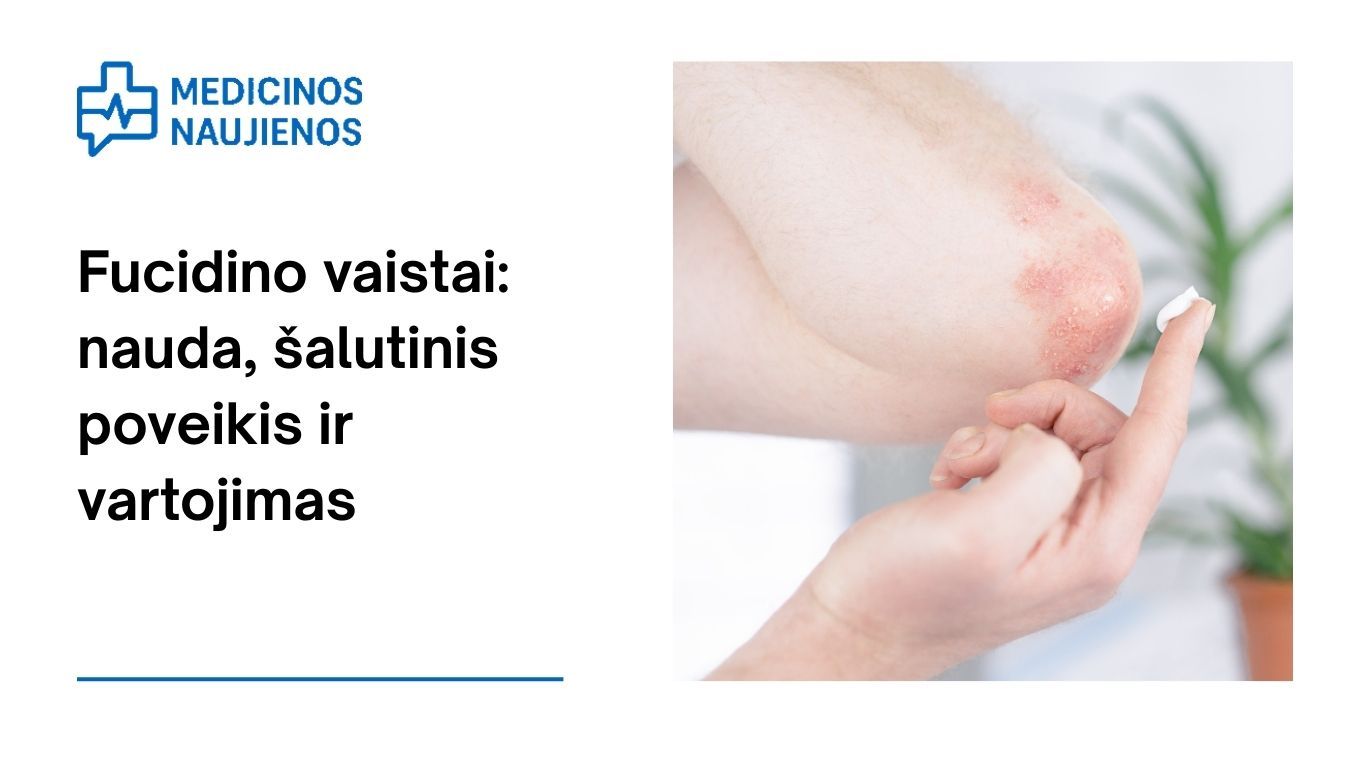 Fucidin tepalas: nauda, galimas šalutinis poveikis, kaip vartoti ir dar daugiau