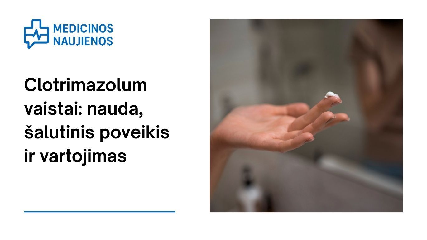Clotrimazolum kremas: kuo jis gali padėti, galimas šalutinis poveikis, kaip vartoti ir dar daugiau