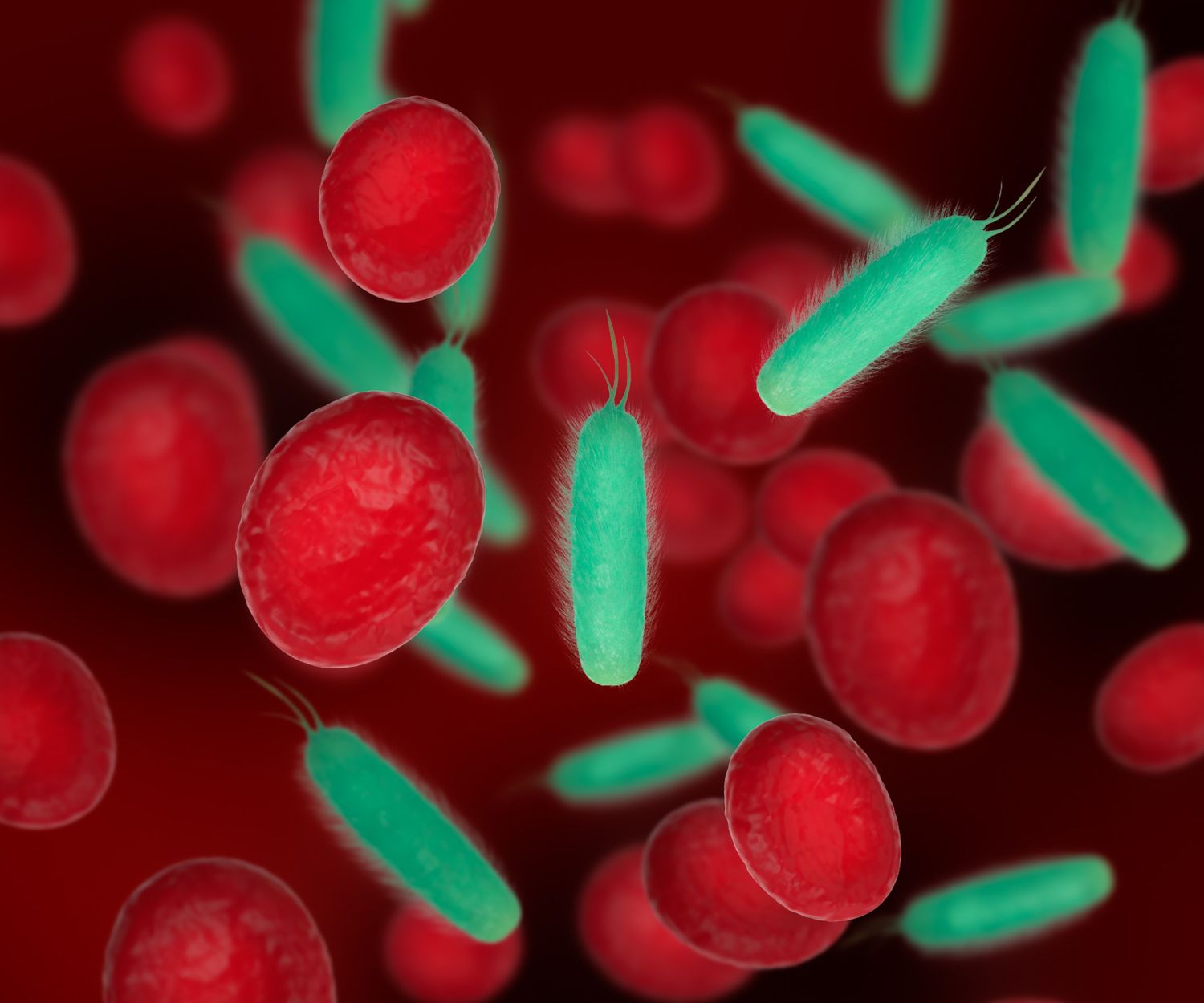 Sepsis: simptomai, priežastys, gydymas, prevencija