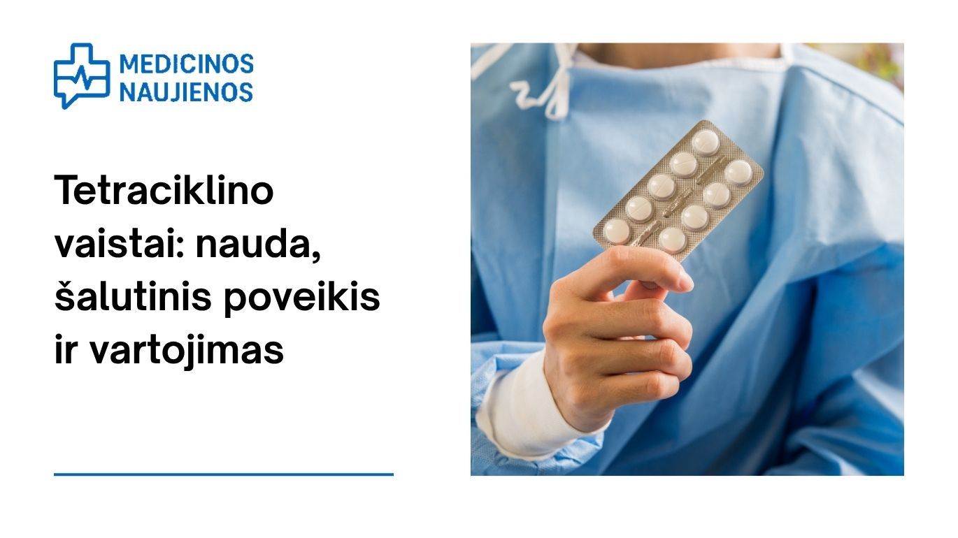 Tetraciklinas: kuo jis gali padėti, galimas šalutinis poveikis, kaip vartoti ir kt.
