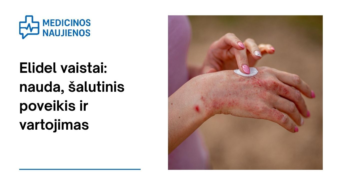 Elidel: nauda, galimas šalutinis poveikis, kaip vartoti ir dar daugiau