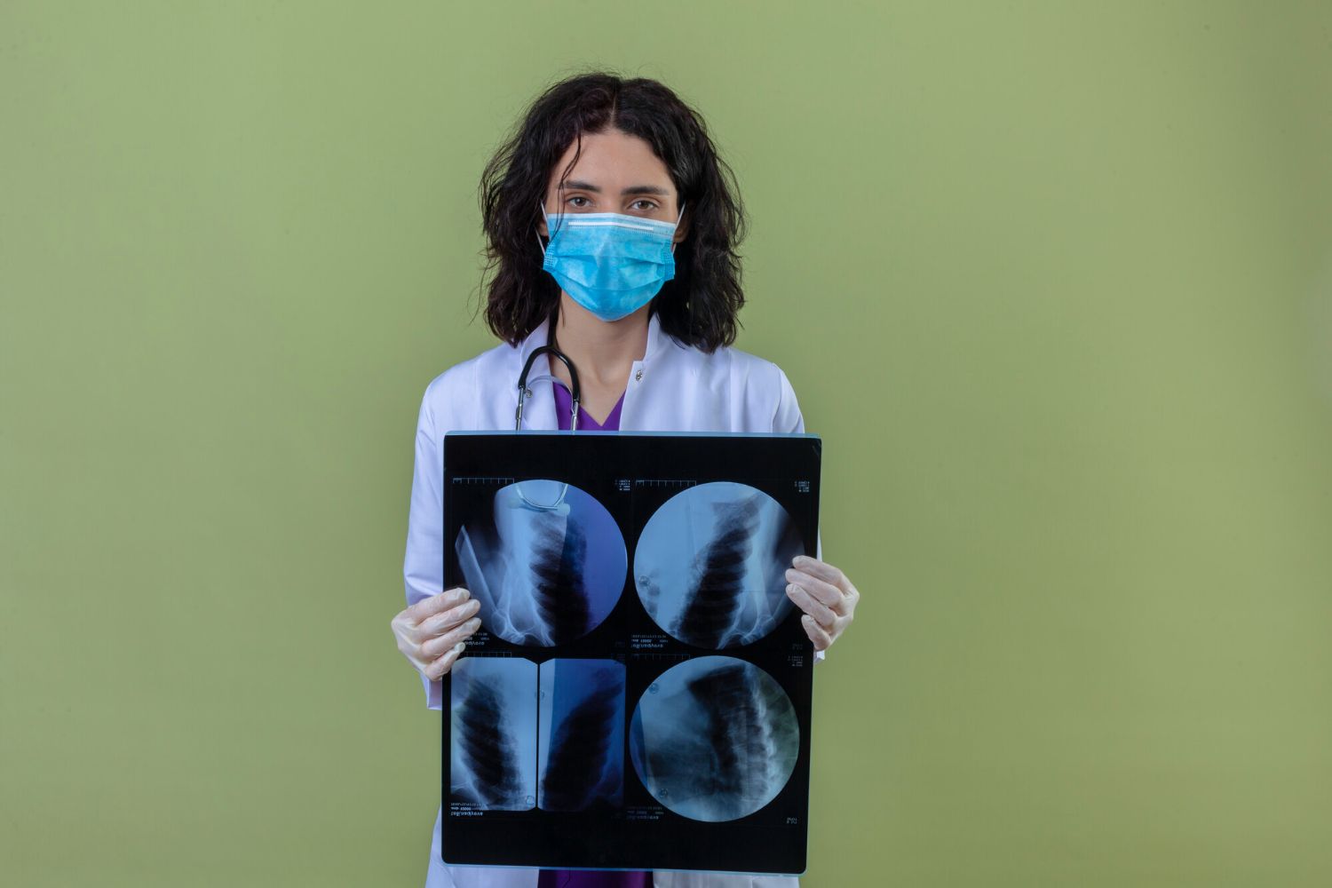Cistinė fibrozė: Simptomai, priežastys, gydymas, prevencija