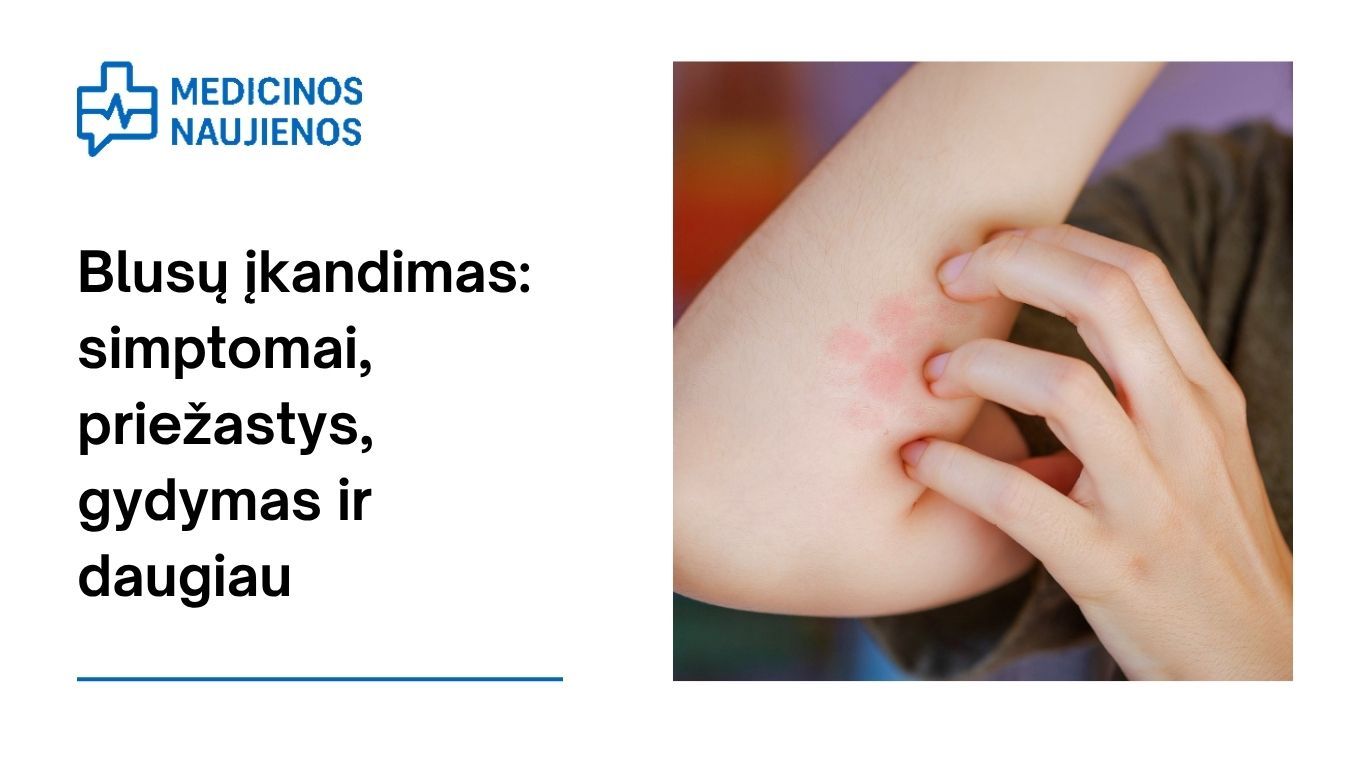 Blusų įkandimas: simptomai, priežastys, gydymas ir daugiau