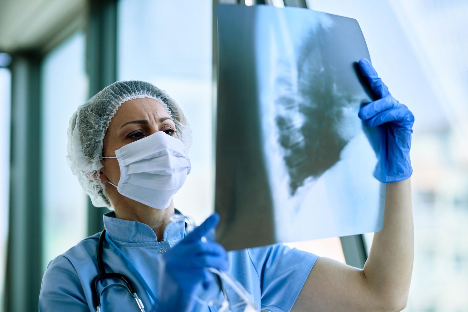 Pneumonija: simptomai, priežastys, gydymas, prevencija