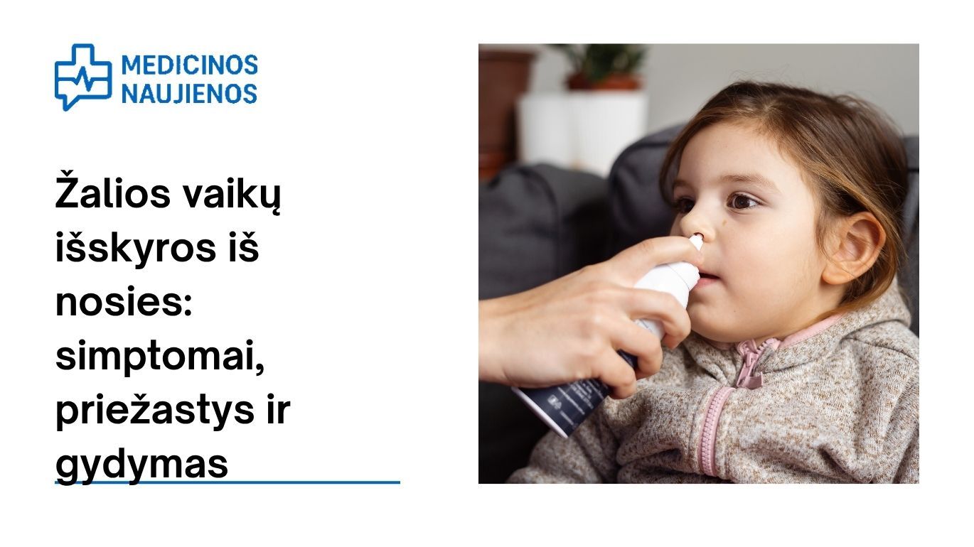 Žalios vaikų išskyros iš nosies: simptomai, priežastys, gydymas ir dar daugiau