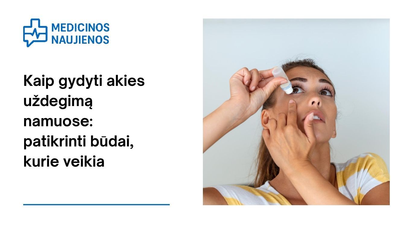 Kaip gydyti akies uždegimą namuose: patikrinti būdai, kurie veikia