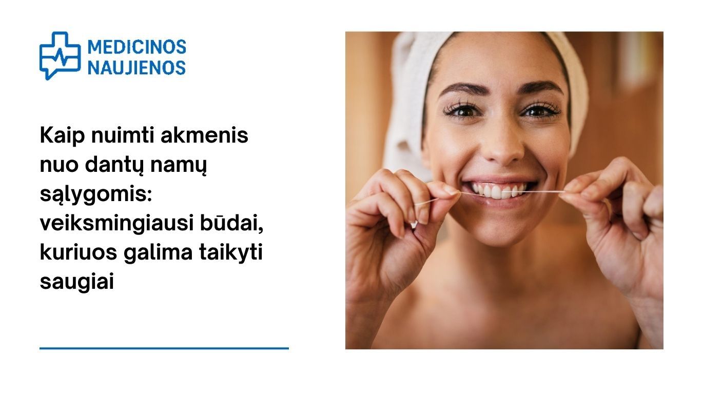 Kaip nuimti akmenis nuo dantų namų sąlygomis: veiksmingiausi būdai, kuriuos galima taikyti saugiai