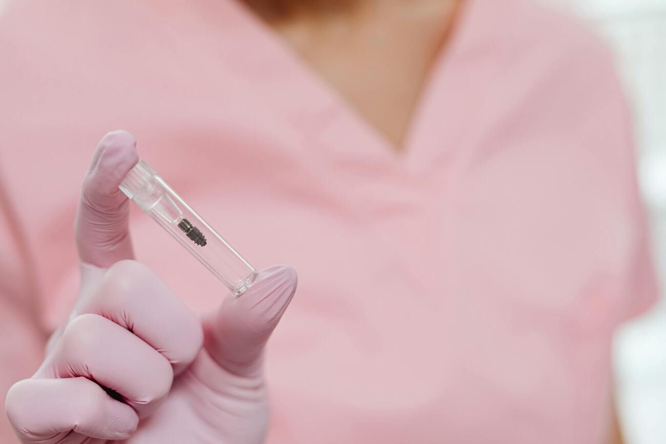 Dantų implantai: kaina, nuo ko ji priklauso ir kaip nepermokėti?