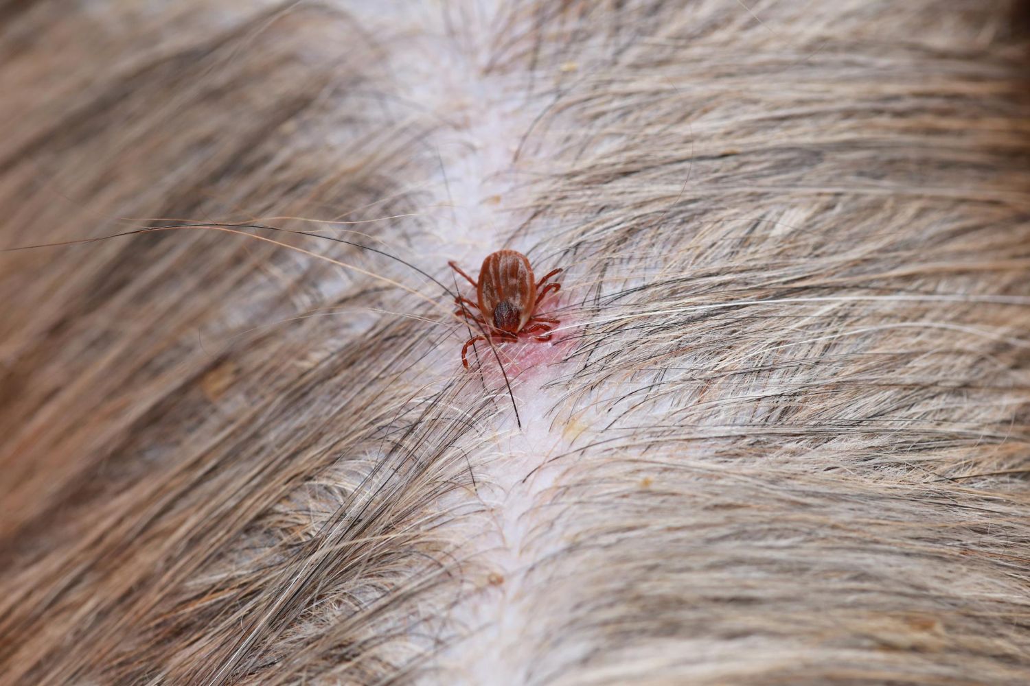 Erkinis encefalitas: Simptomai, prevencija, gydymas