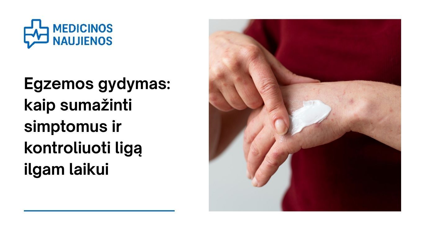 Egzemos gydymas: kaip sumažinti simptomus ir kontroliuoti ligą ilgam laikui
