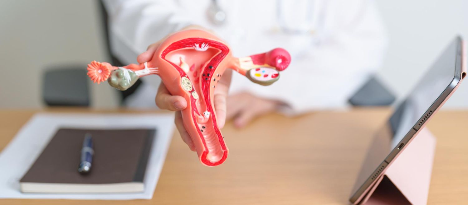 Adenomioze: simptomai, priežastys, gydymas, prevencija