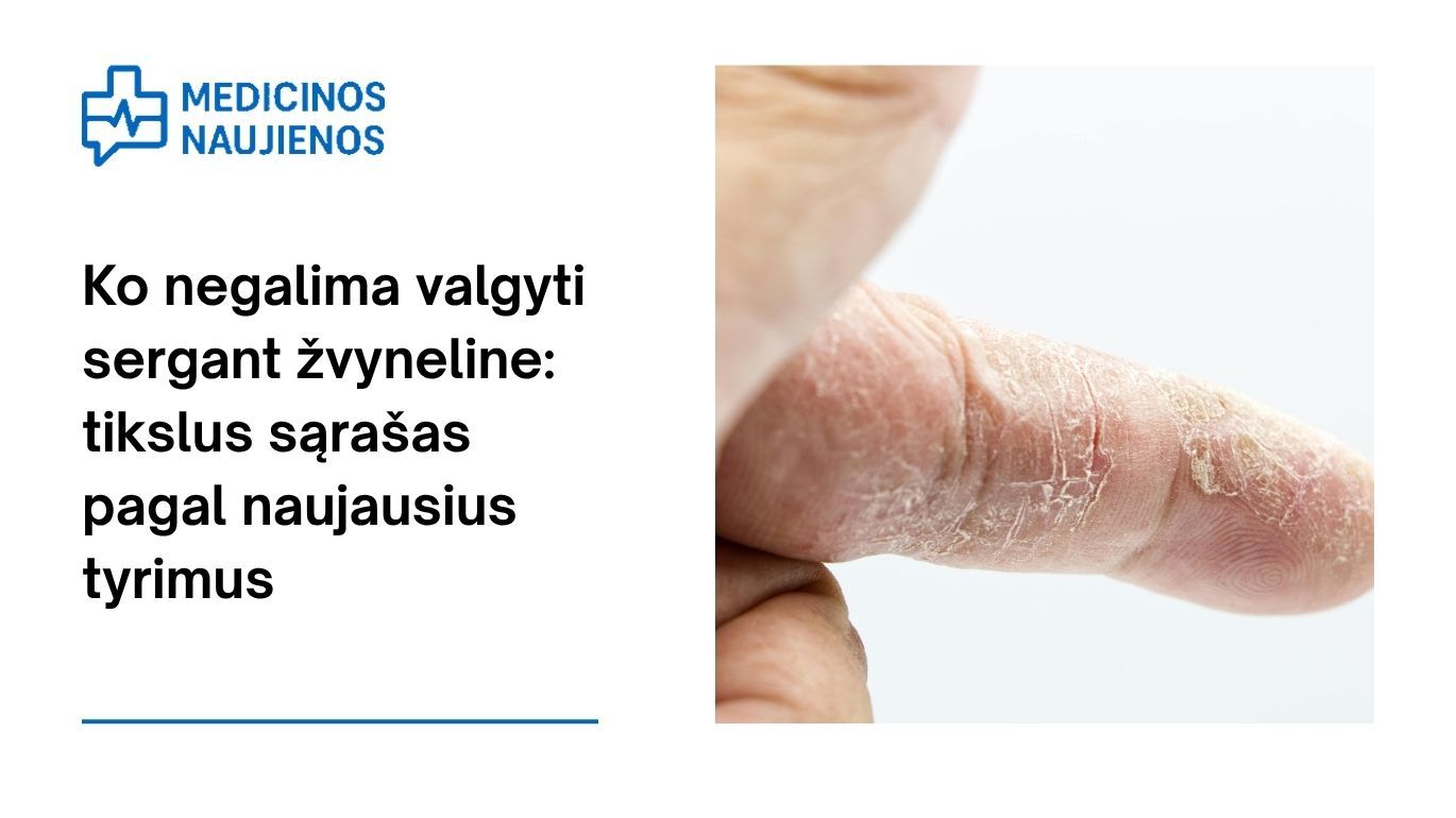 Ko negalima valgyti sergant žvyneline: tikslus sąrašas pagal naujausius tyrimus