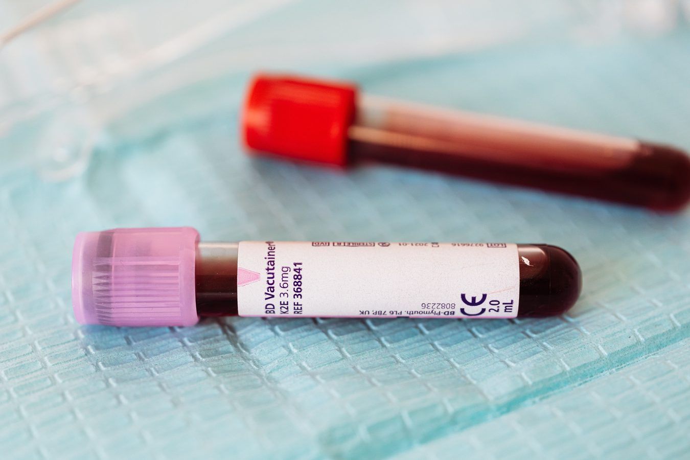 Anglija naikina hepatitą C: gydymo tikslas jau pasiektas