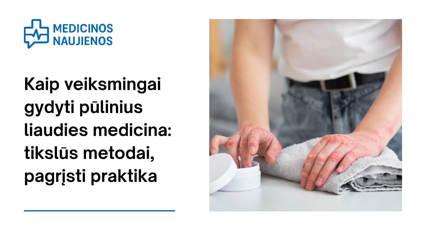 Kaip veiksmingai gydyti pūlinius liaudies medicina: tikslūs metodai, pagrįsti praktika