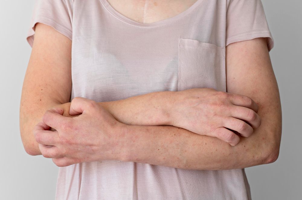 Hidradenitas: Simptomai, priežastys, gydymas, prevencija
