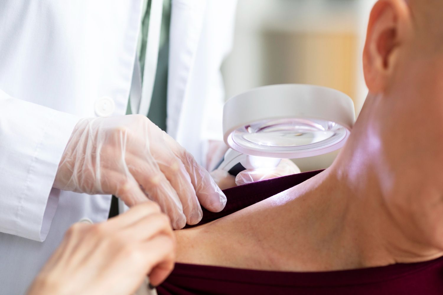 Odos vėžys (melanoma): Simptomai, priežastys, gydymas, prevencija.