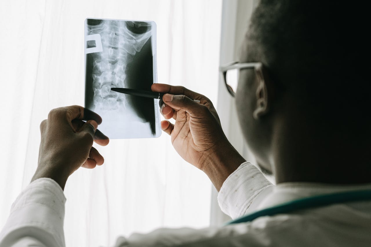 Skersinis mielitas: Simptomai, priežastys, gydymas, prevencija