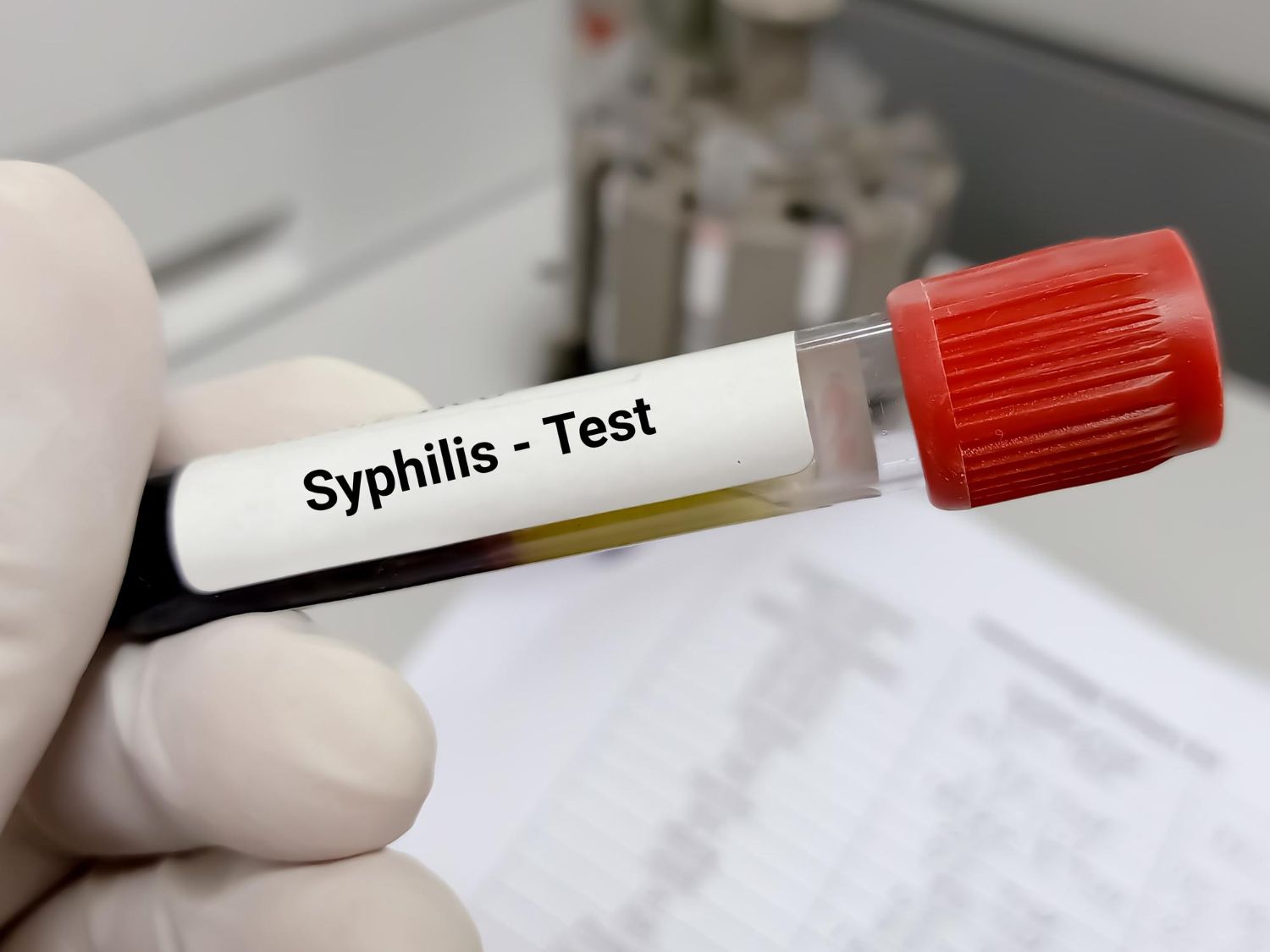 Sifilis: Simptomai, priežastys, gydymas, prevencija