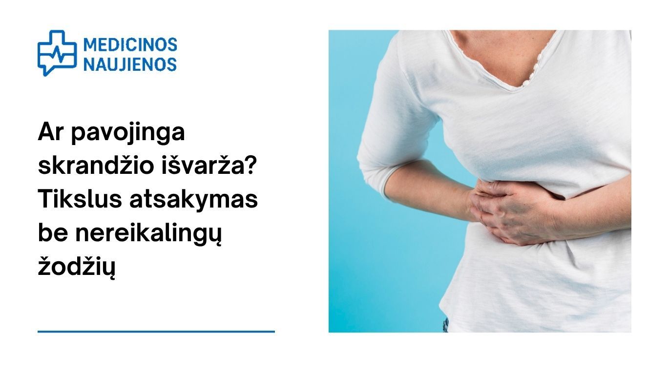 Ar pavojinga skrandžio išvarža? Tikslus atsakymas be nereikalingų žodžių