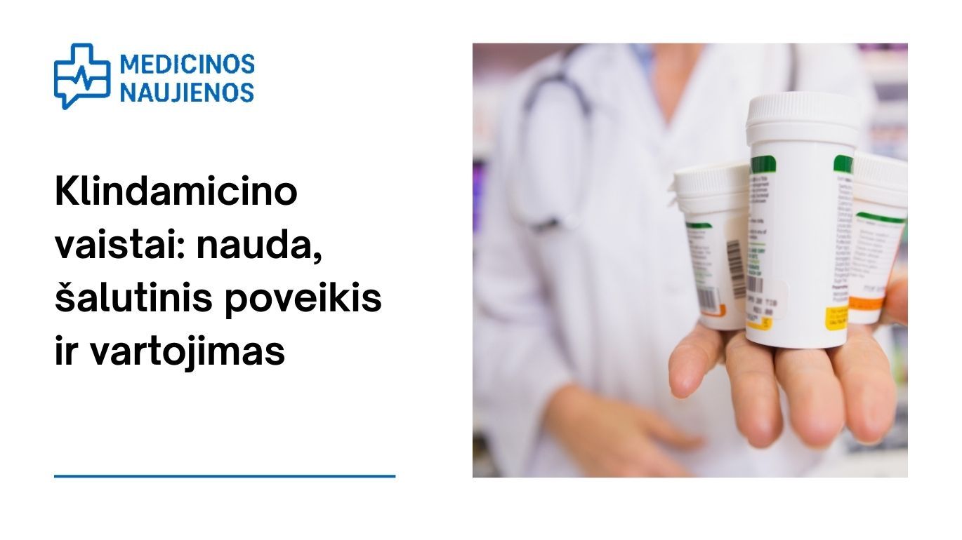 Klindamicinas: nauda, galimas šalutinis poveikis, kaip vartoti ir dar daugiau