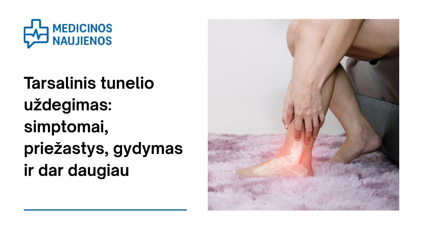 Tarsalinis tunelio uždegimas: simptomai, priežastys, gydymas ir dar daugiau