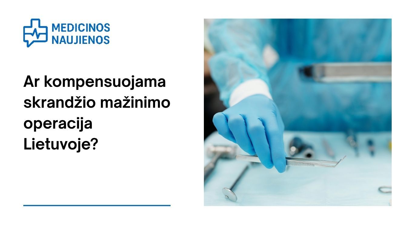 Ar kompensuojama skrandžio mažinimo operacija Lietuvoje? Atsakymas, kuris padės priimti sprendimą