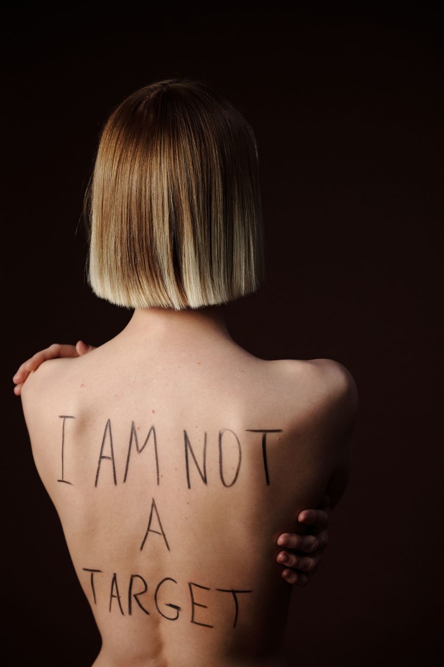 Endometriozė privertė Carą Cressy palikti modelio darbą