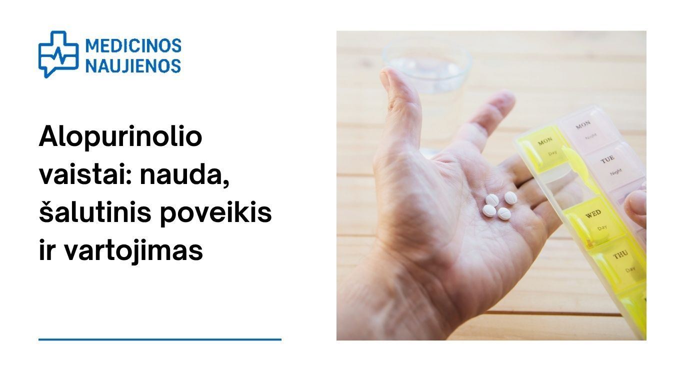 Alopurinolis: kuo jis gali padėti, galimas šalutinis poveikis, kaip vartoti ir dar daugiau