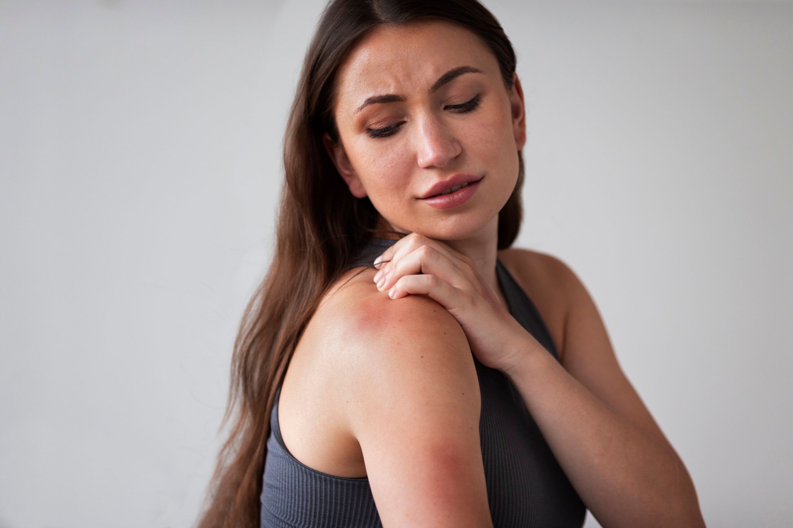 Juostinė pūslelinė: Simptomai, priežastys, gydymas, prevencija