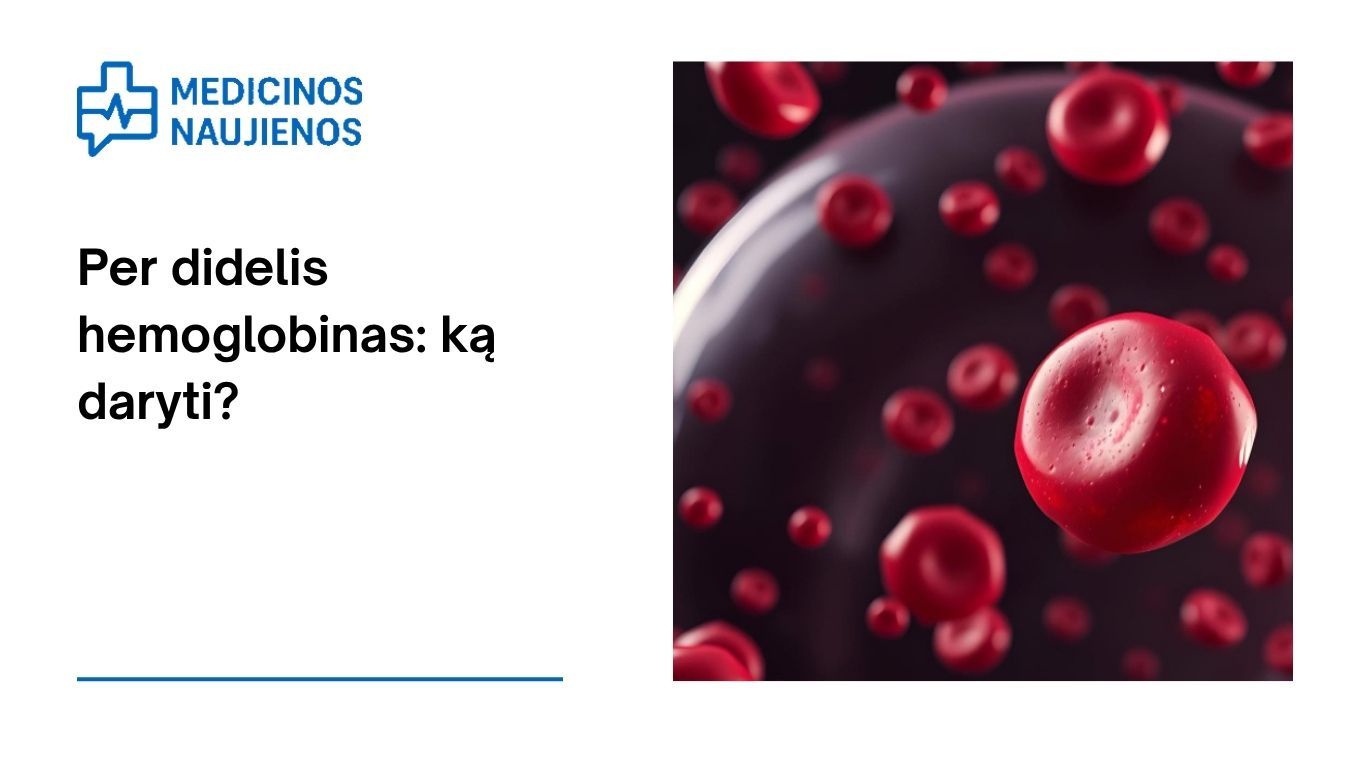 Per didelis hemoglobinas: ką daryti?