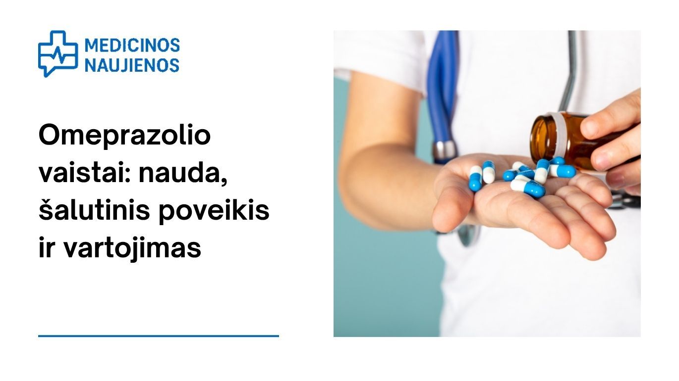 Omeprazolis: kuo jis gali padėti, galimas šalutinis poveikis, kaip vartoti ir dar daugiau