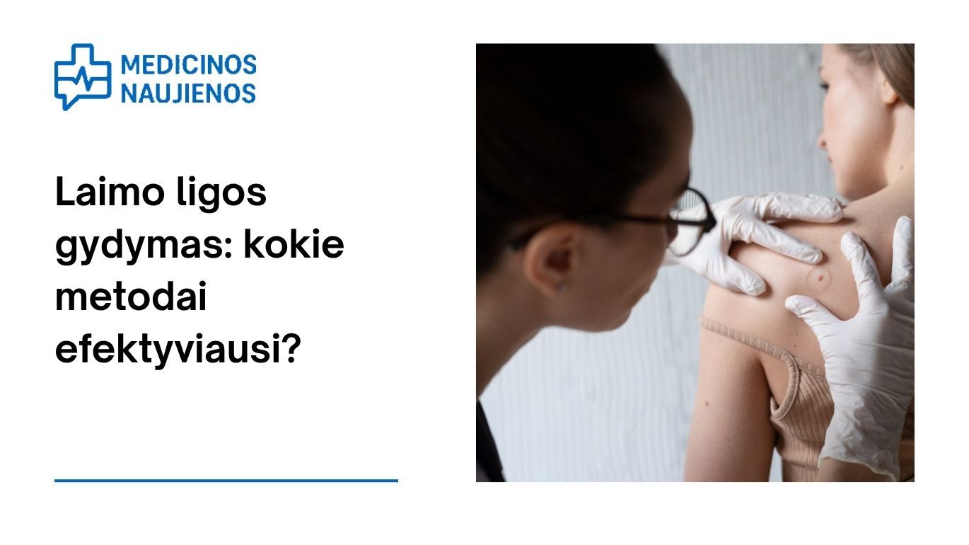 Laimo ligos gydymas: kokie metodai efektyviausi?
