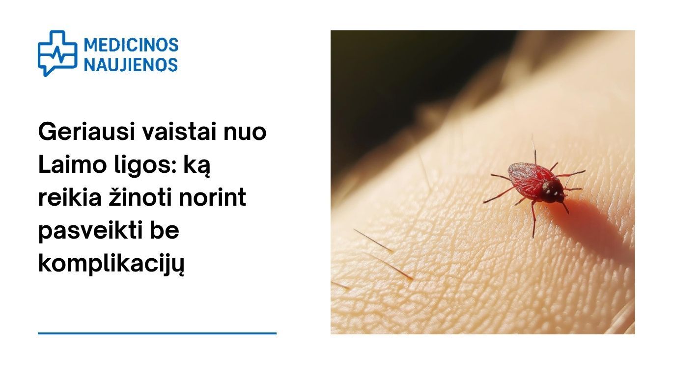 Geriausi vaistai nuo Laimo ligos: ką reikia žinoti norint pasveikti be komplikacijų