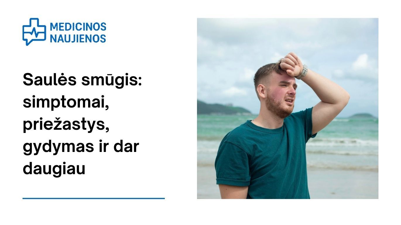 Saulės smūgis: simptomai, priežastys, gydymas ir dar daugiau
