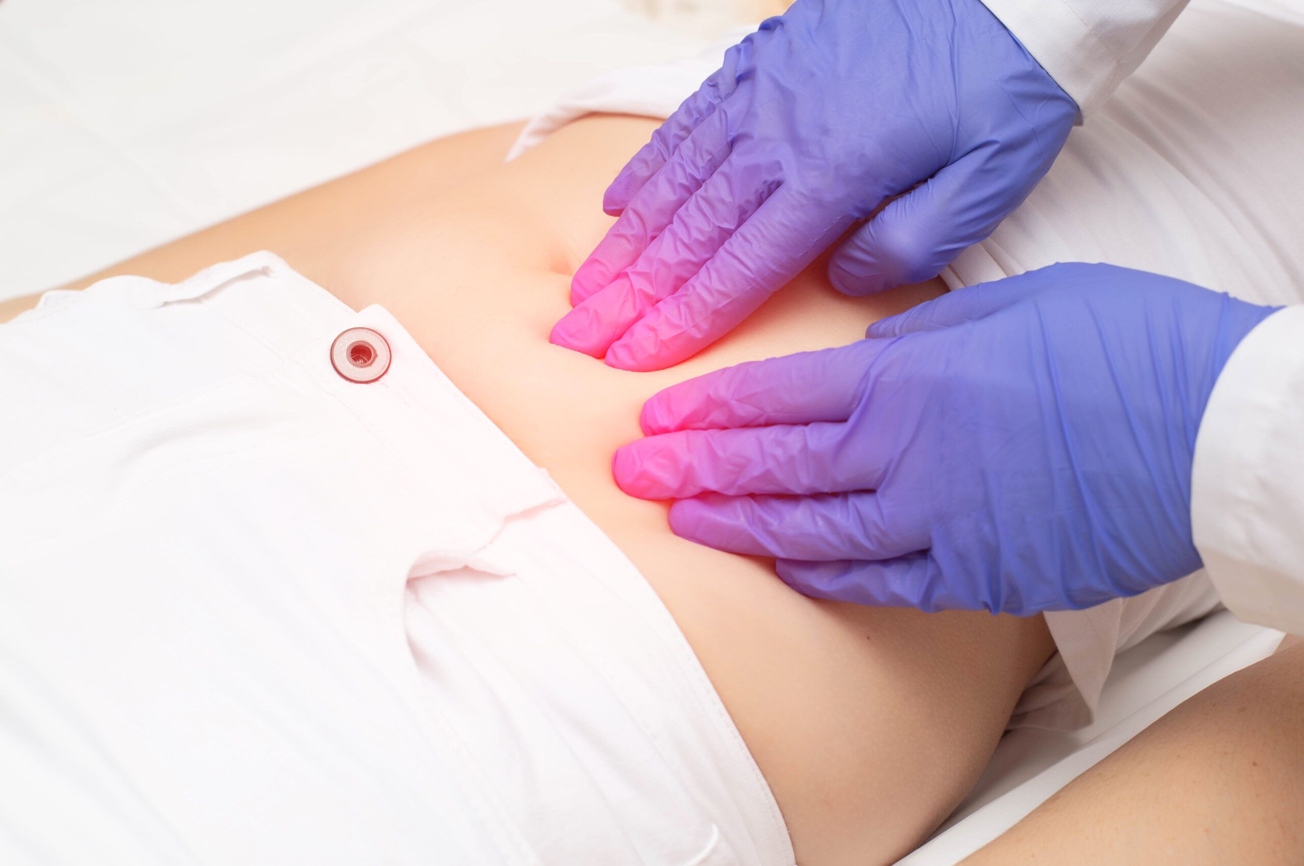 Gimdos mioma: Simptomai, priežastys, gydymas, prevencija