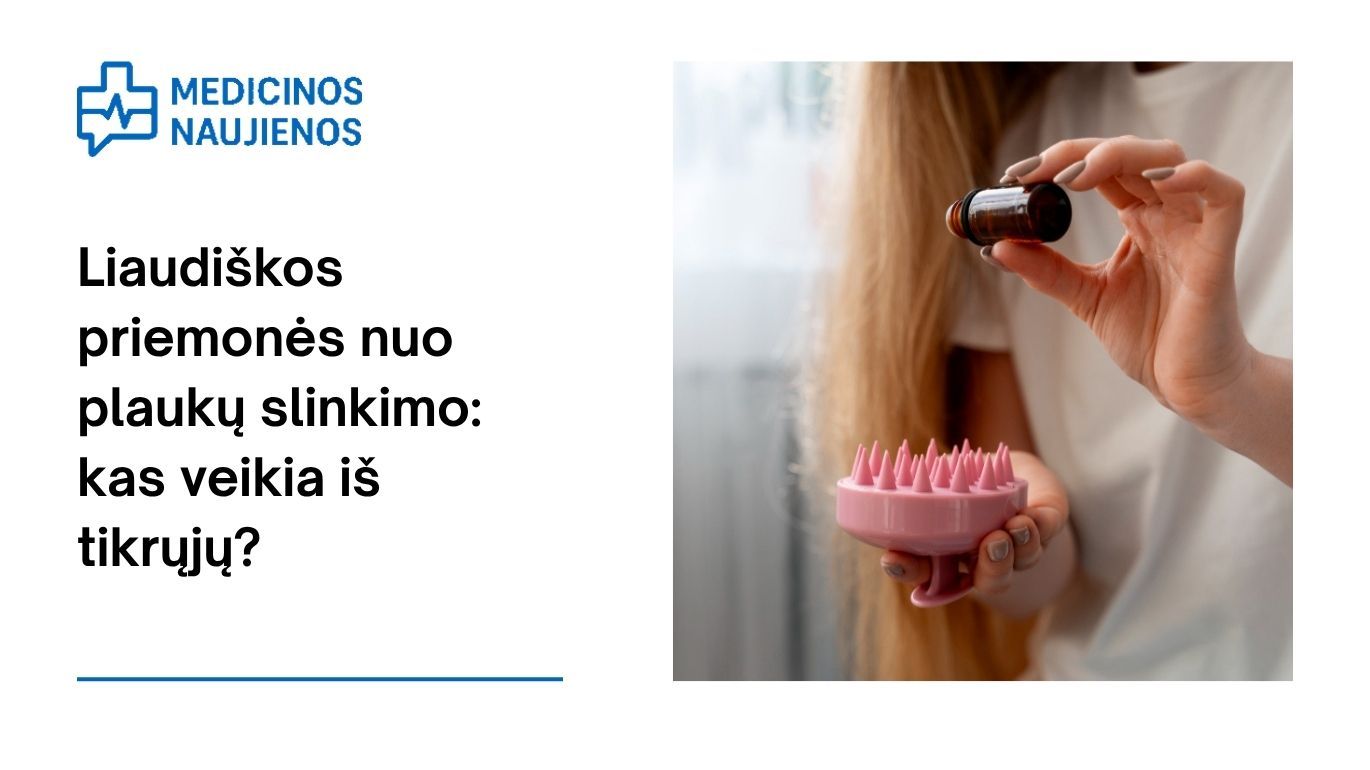 Liaudiškos priemonės nuo plaukų slinkimo: kas veikia iš tikrųjų?