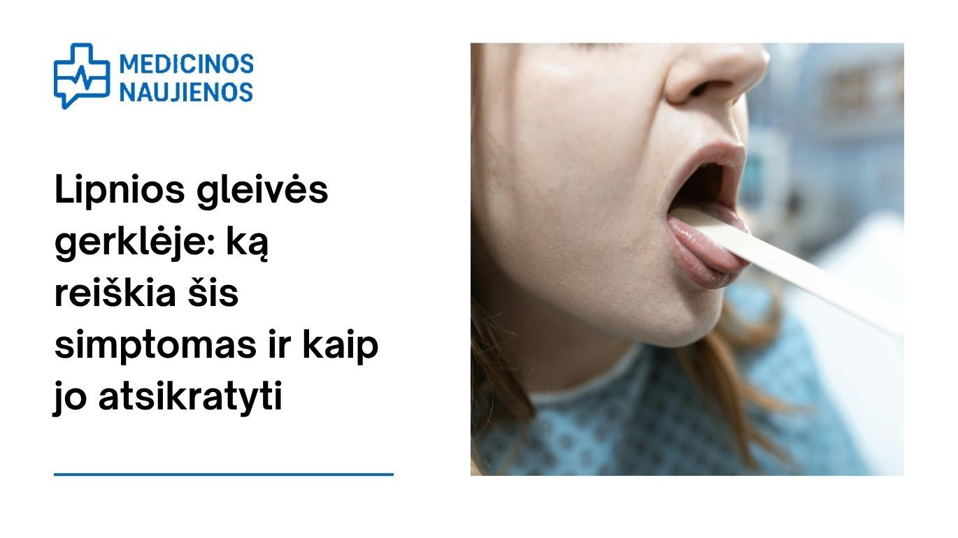 Lipnios gleivės gerklėje: ką reiškia šis simptomas ir kaip jo atsikratyti
