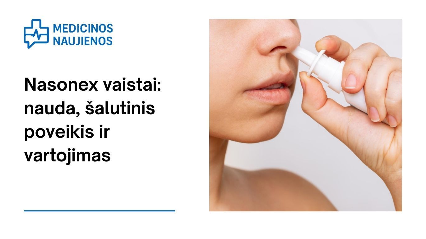 Nasonex: nauda, galimas šalutinis poveikis, kaip vartoti ir dar daugiau