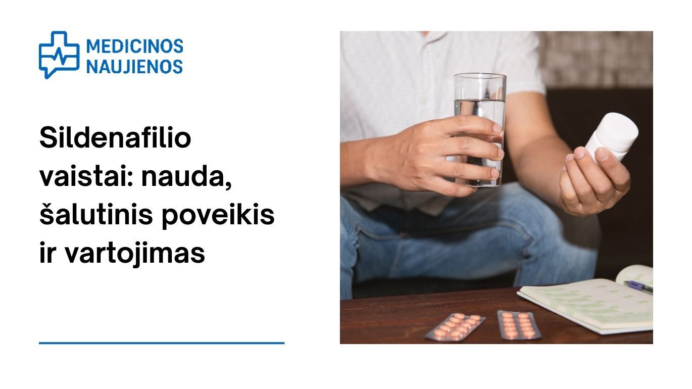 Sildenafilis: nauda, galimas šalutinis poveikis, kaip vartoti ir dar daugiau