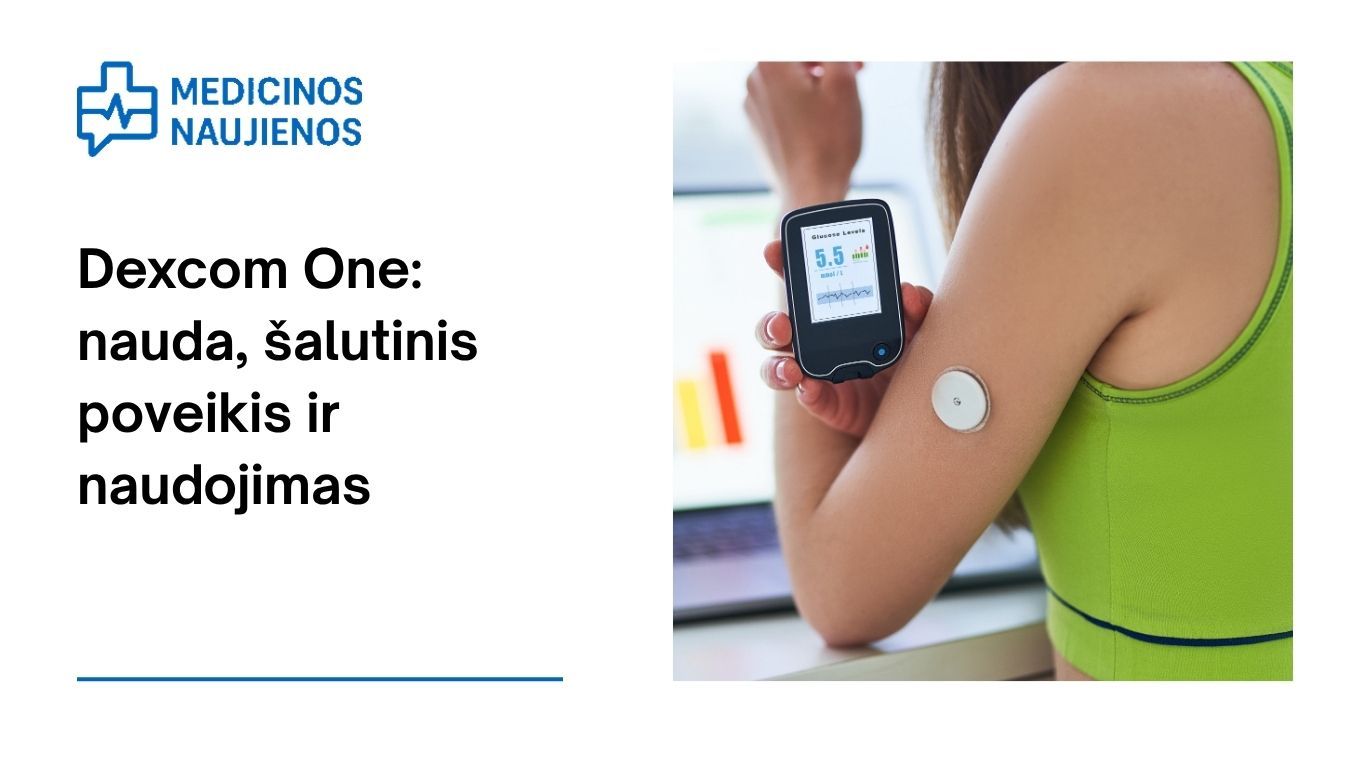 Dexcom One: kuo gali padėti, galimas šalutinis poveikis, kaip naudoti ir dar daugiau