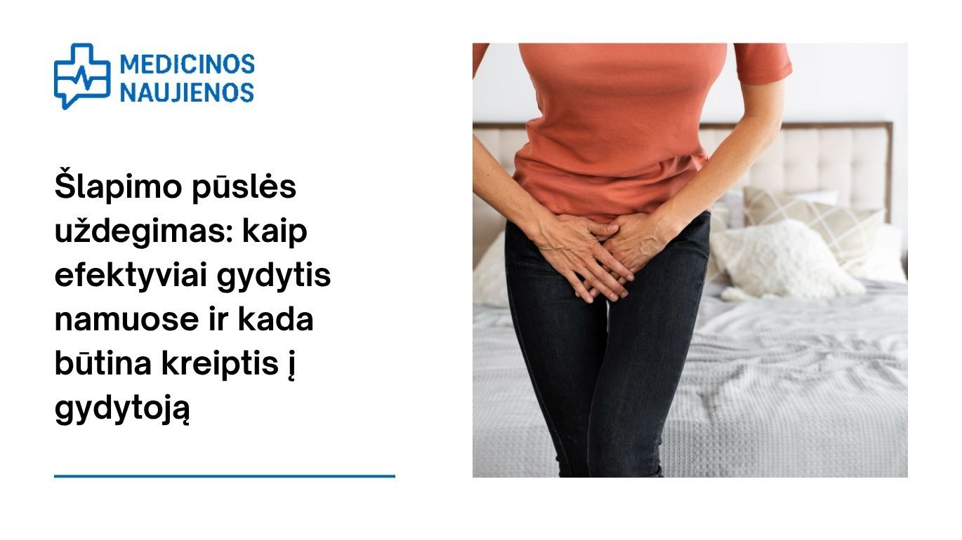 Šlapimo pūslės uždegimas: kaip efektyviai gydytis namuose ir kada būtina kreiptis į gydytoją