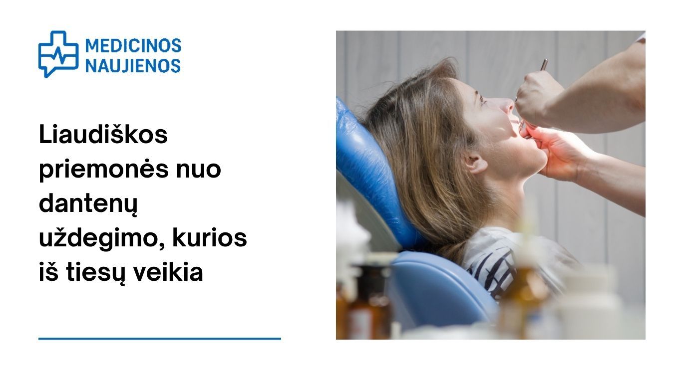 Liaudiškos priemonės nuo dantenų uždegimo, kurios iš tiesų veikia
