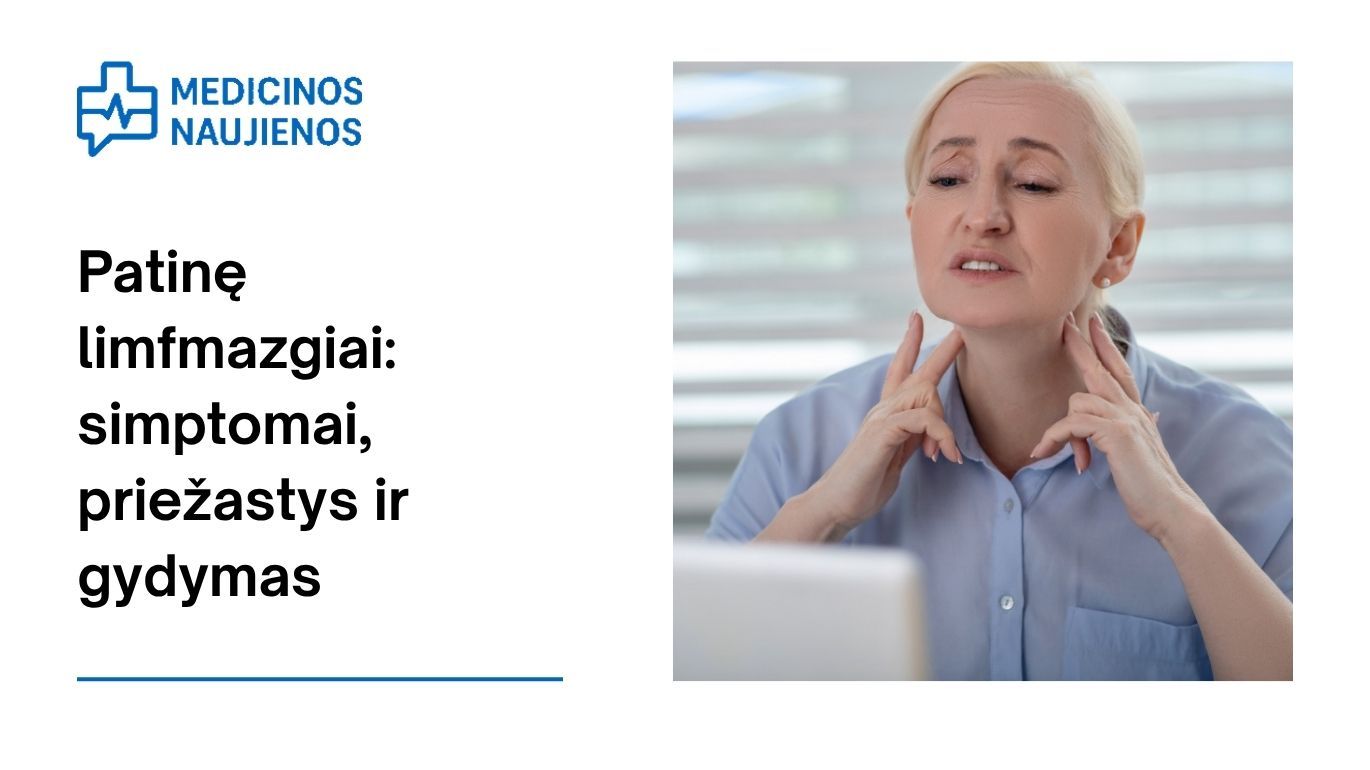 Padidėję limfmazgiai: simptomai, priežastys, gydymas ir kt.